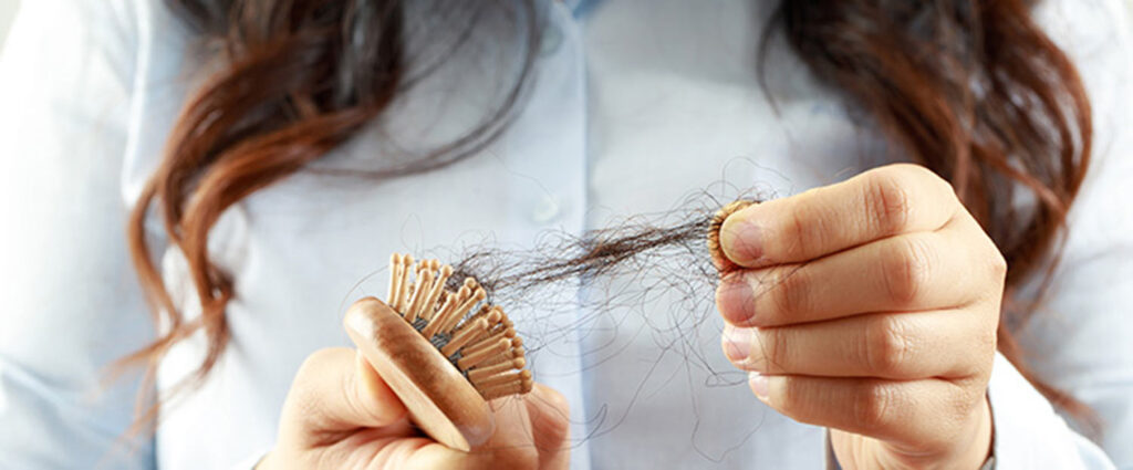 Umgang der Österreicherinnen und Österreicher mit Haarausfall