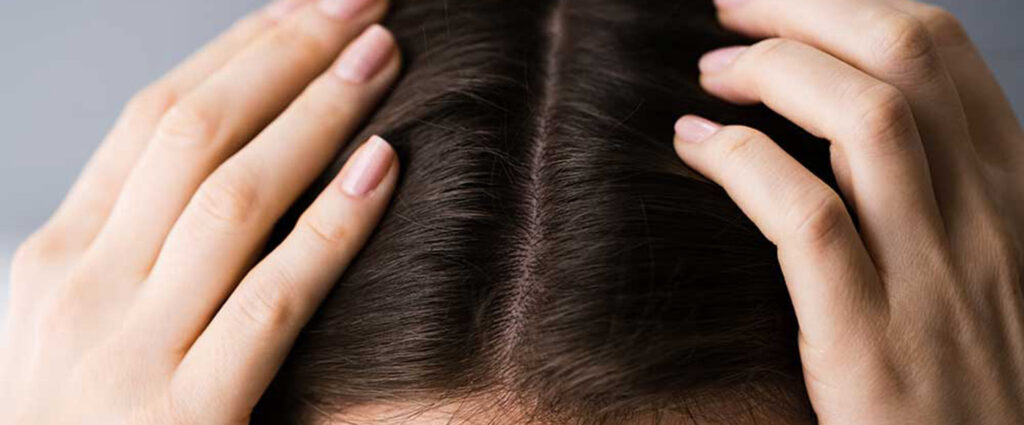 Haarausfall und seine Ursachen