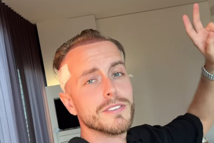 Feel good! Selbstbewusstsein durch optische Veränderung: Juliencos offenes Gespräch über Haartransplantation
